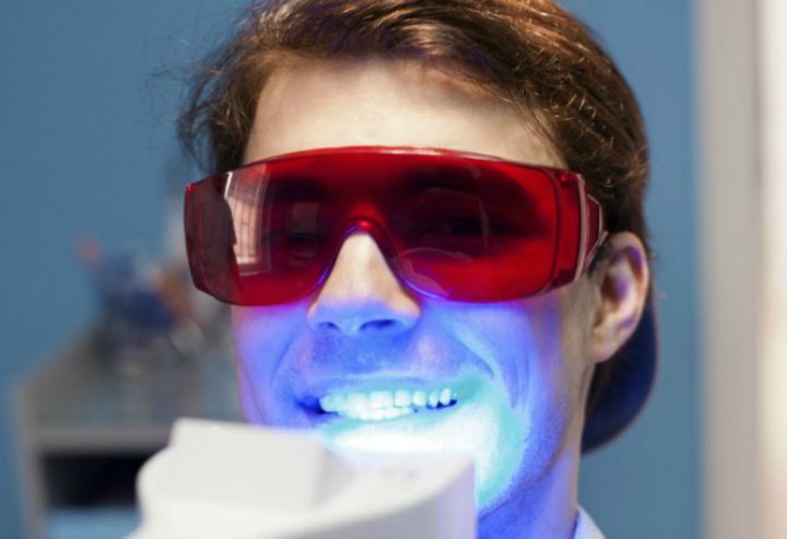 Laser Teeth Whitening